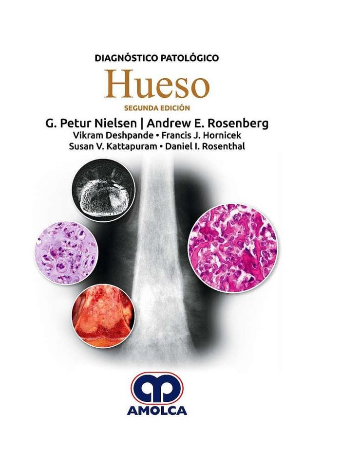 DIAGNOSTICO PATOLOGICO HUESO, de ROSENBERG,A | portada del libro