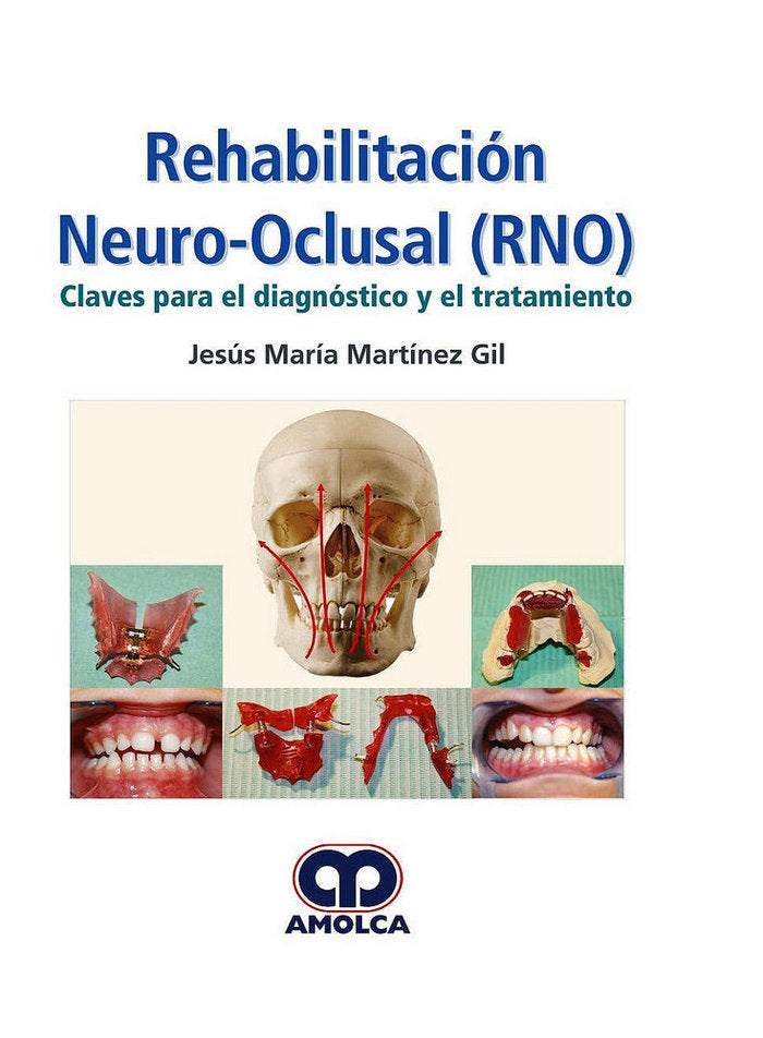 REHABILITACION NEURO-OCLUSAL (RNO) CLAVES PARA EL DIAGNOSTICO Y EL TRATAMIENTO, de MARTINEZ-GIL, J. | portada del libro