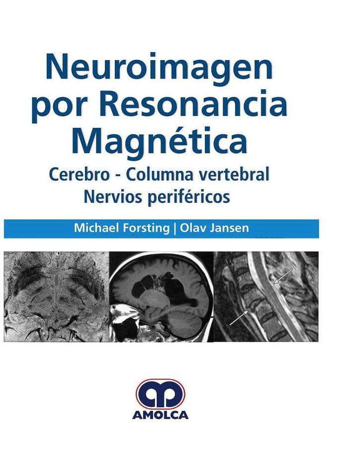 NEUROIMAGEN POR RESONANCIA MAGNETICA, de JANSEN,O | portada del libro