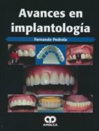 Avances en implantolog¡a, de PEDROLA | portada del libro