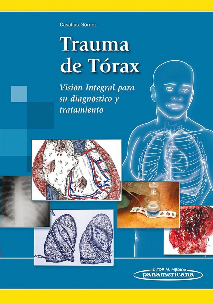 CASALLAS:Trauma de Torax, de CASALLAS GOMEZ, ALVARO | portada del libro