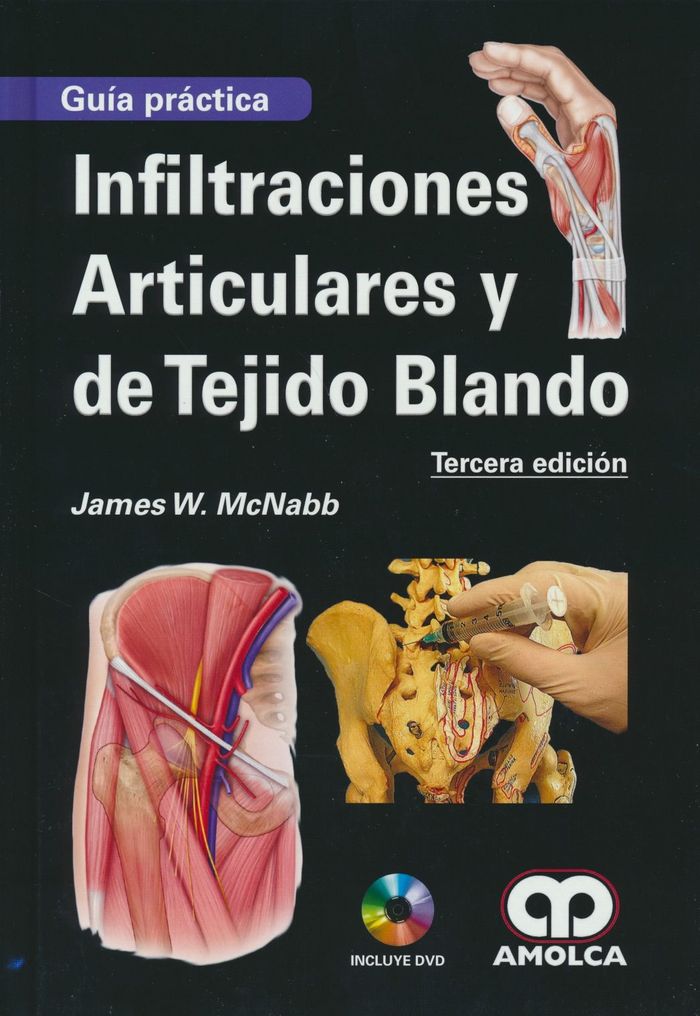 INFILTRACIONES ARTICULARES Y DE TEJIDO BLANDO GUIA PRACTICA, de MCNABB | portada del libro