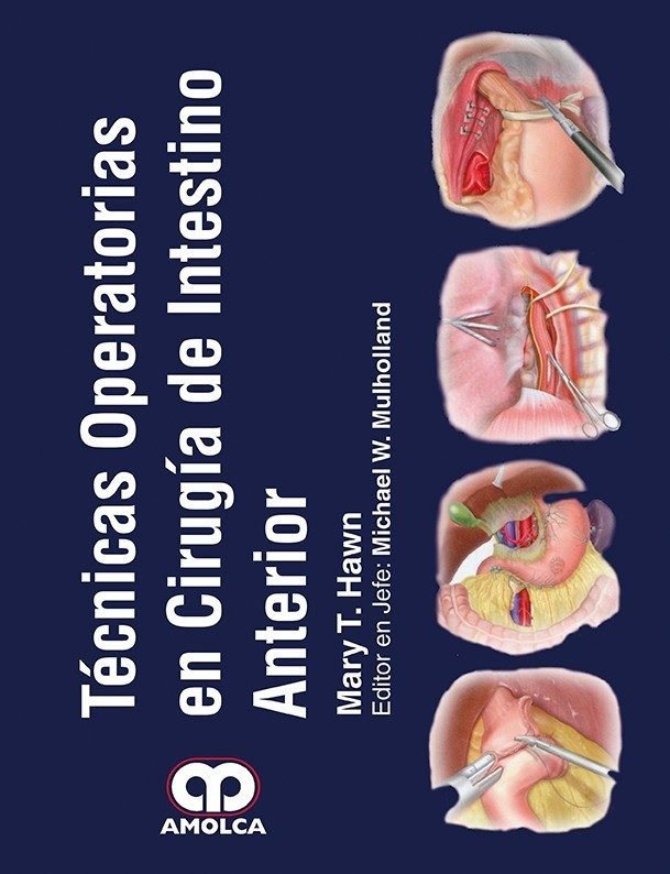 TECNICAS OPERATORIAS EN CIRUGIA DE INTESTINO ANTERIOR | portada del libro