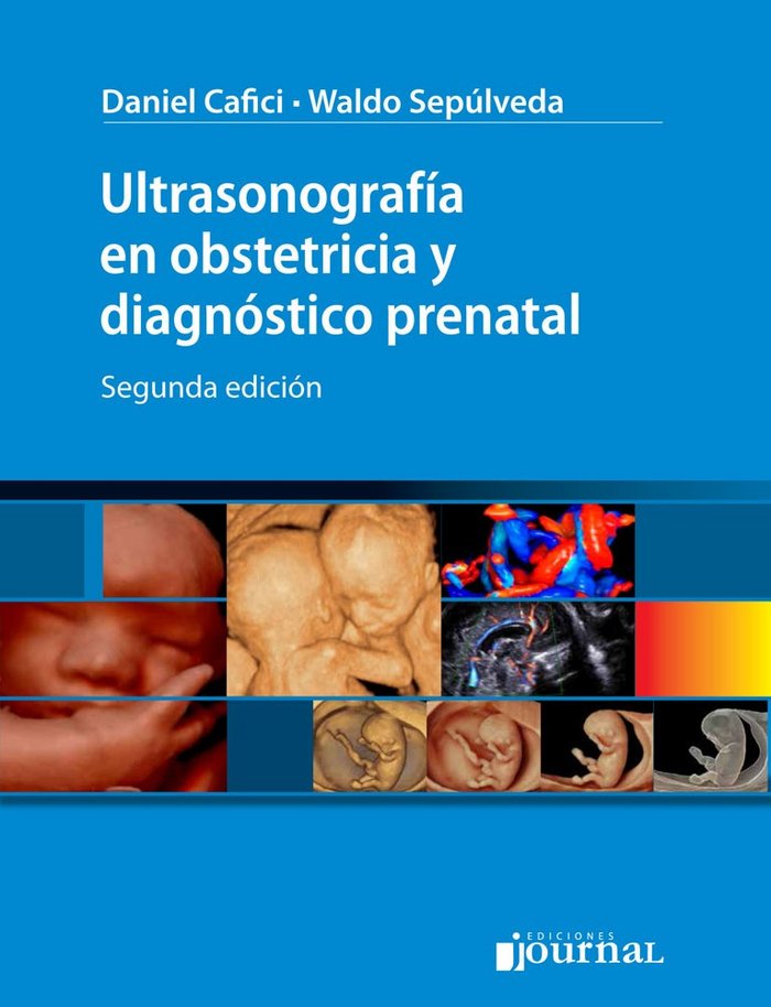 ULTRASONOGRAFIA EN OBSTETRICIA Y DIAGNOSTICO PRENATAL, de CAFICI#SEPULVEDA | portada del libro