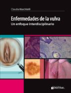 ENFERMEDADES DE LA VULVA, de CLAUDIA MARCHITELLI | portada del libro