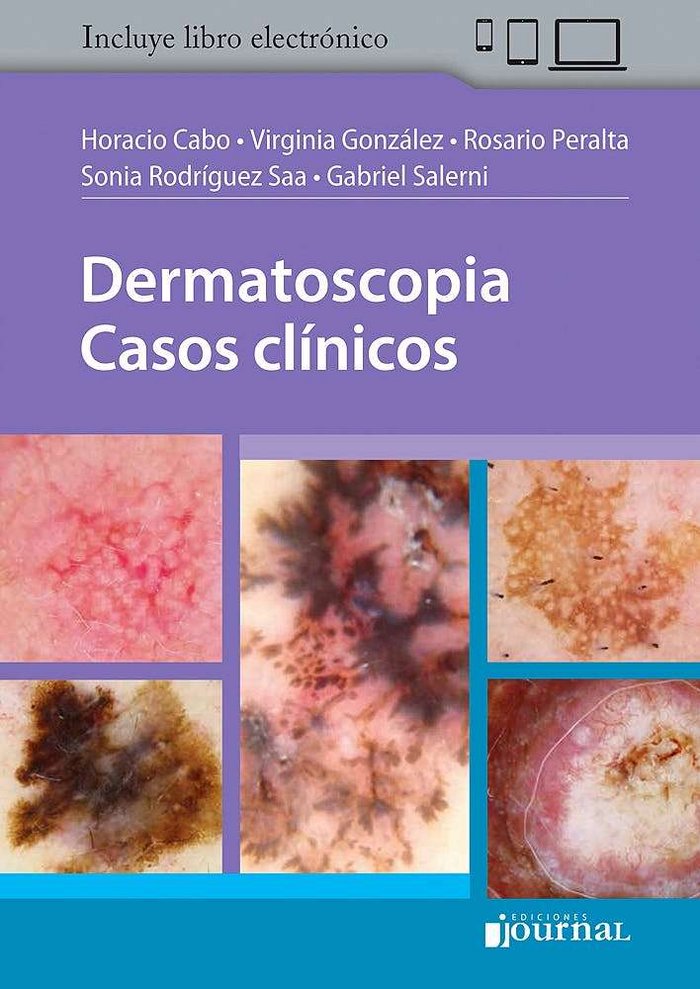 DERMATOSCOPIA CASOS CLINICOS, de CABO,H | portada del libro
