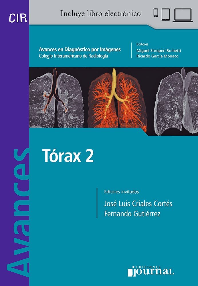 AVANCES EN DIAGNOSTICO POR IMAGENES 17 TORAX 2, de CRIALES,J | portada del libro