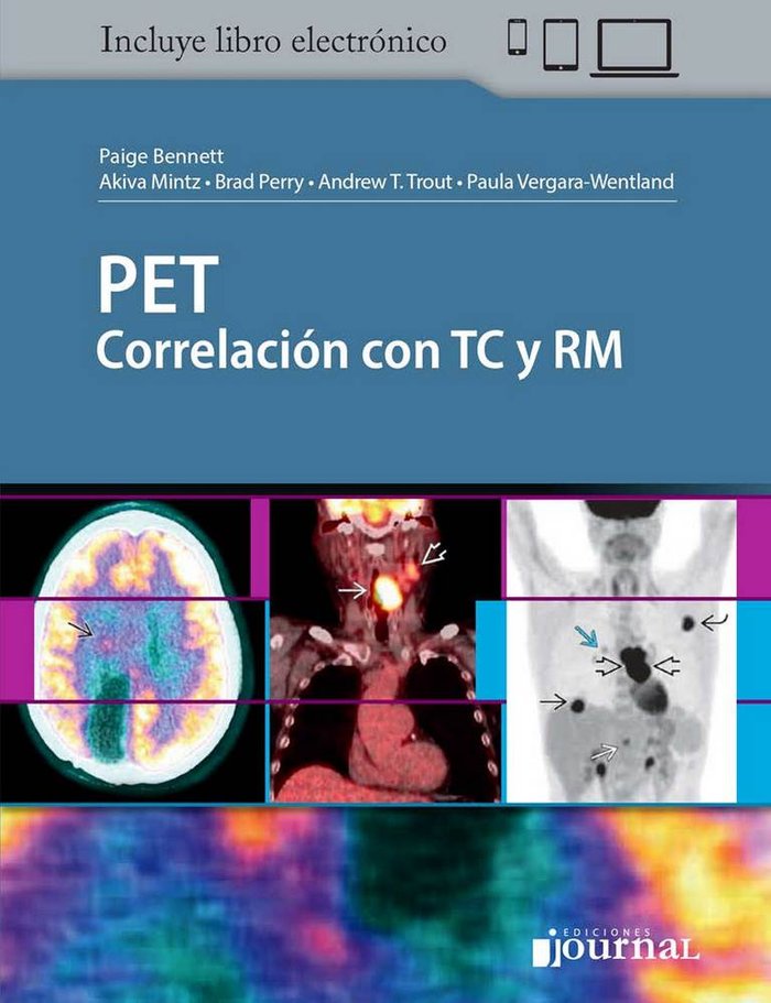 PET Correlación con TC y RM (Incluye Libro Electrónico), de BENNETT,P | portada del libro