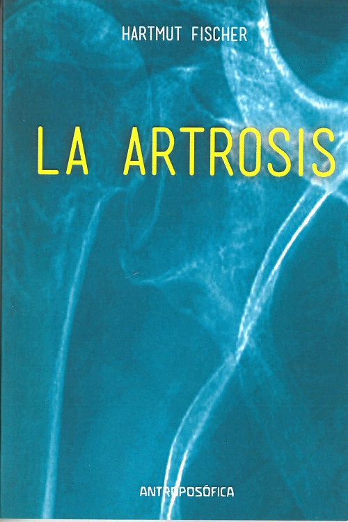 La artrosis, de Hartmut | portada del libro
