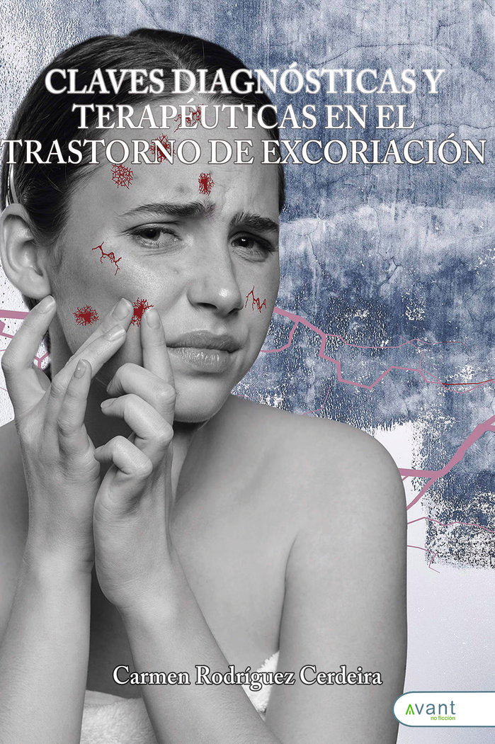 CLAVES DIAGNÓSTICAS Y TERAPÉUTICAS EN EL TRASTORNO DE EXCORI, de Rodríguez Cerdeira, Carmen | portada del libro