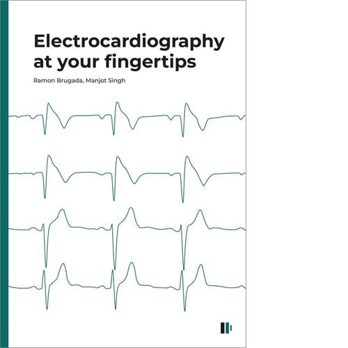 Electrocardiography at your fingertips, de BRUGADA TERRADELLAS | portada del libro